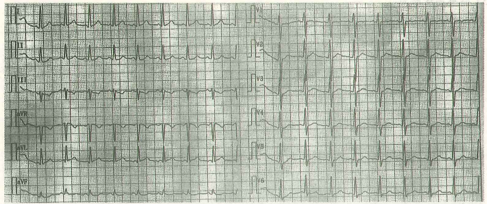 image-20250613164034309