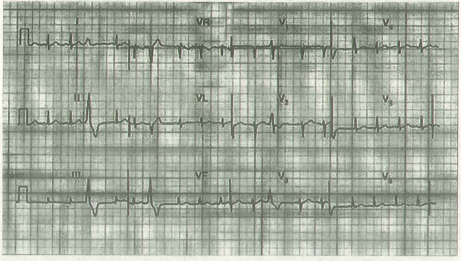 image-20250613171439870