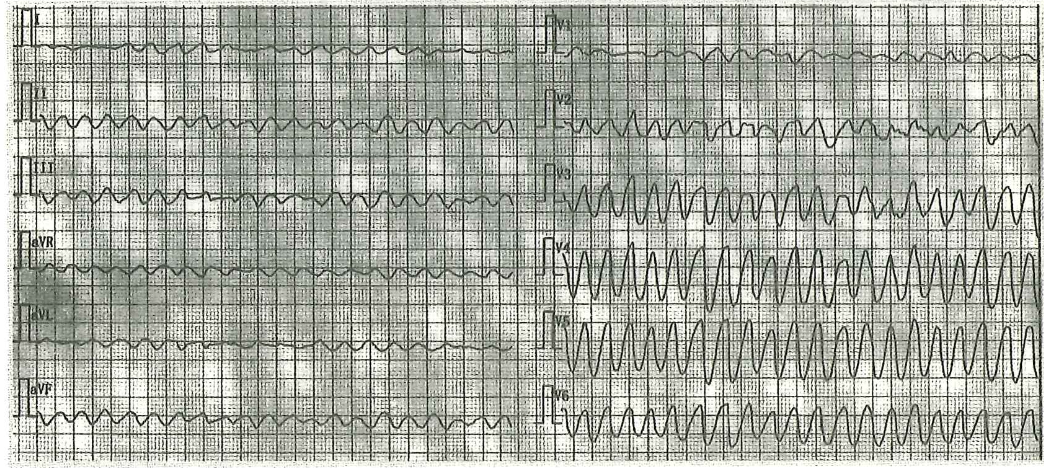 image-20250613174455976
