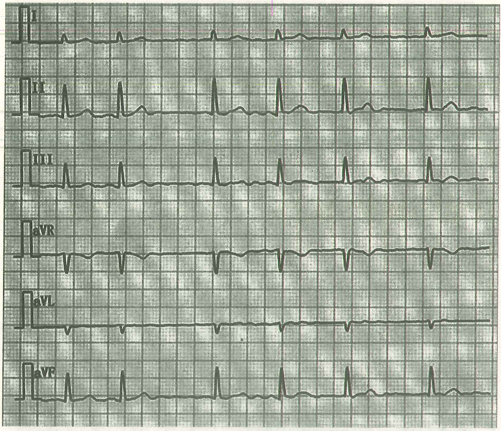 image-20250613174712414