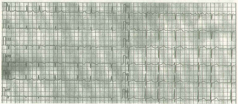 image-20250613175041415