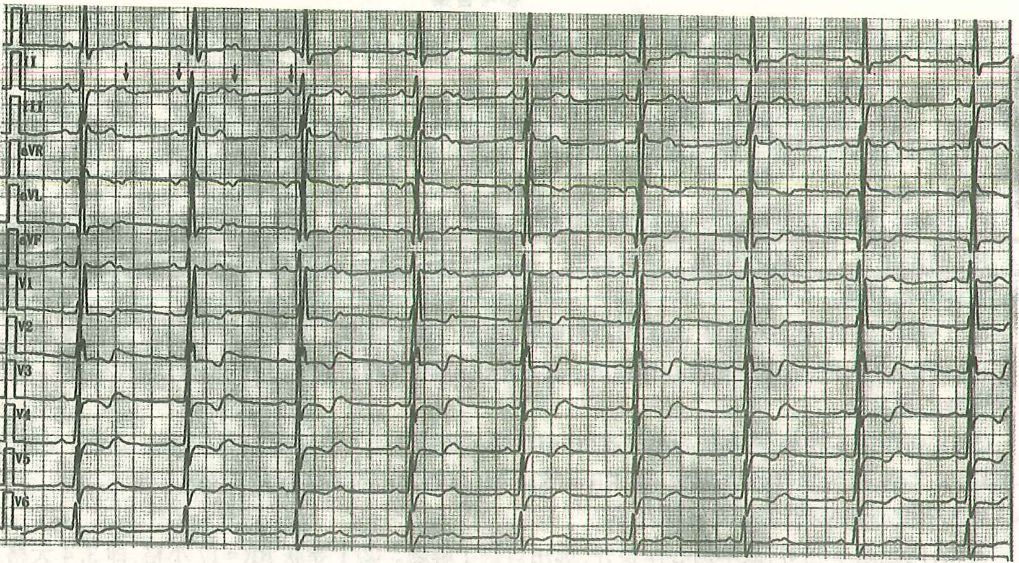 image-20250613175232243