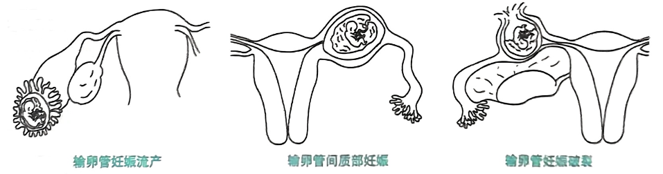 image-20250815203802840