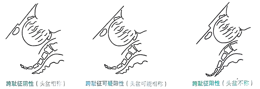 image-20250816212033497