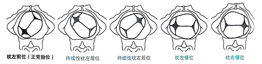 image-20250816212729638