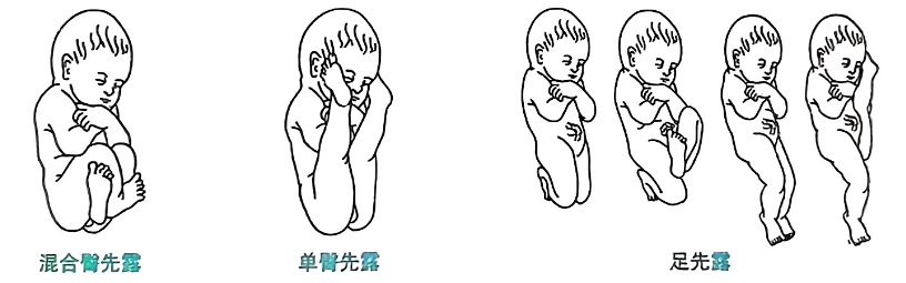 image-20250816213104052