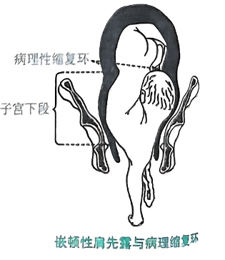 image-20250816213432776