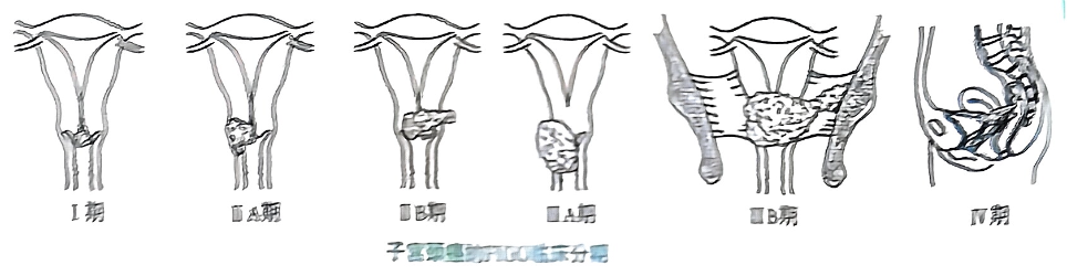 image-20250817204247962