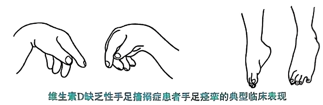 image-20250818171529202
